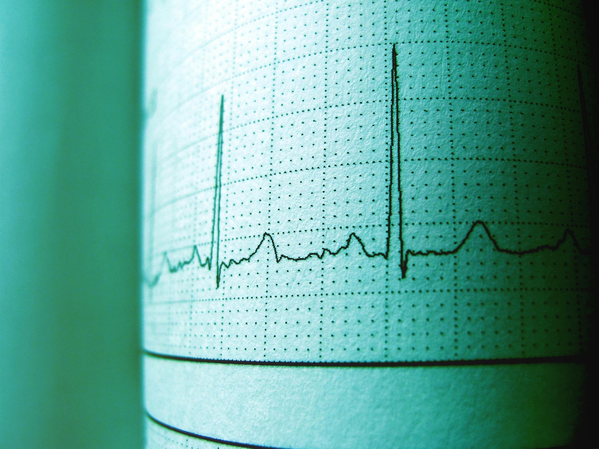 Life After the Scar: Redefining Strength Post-Open Heart Surgery