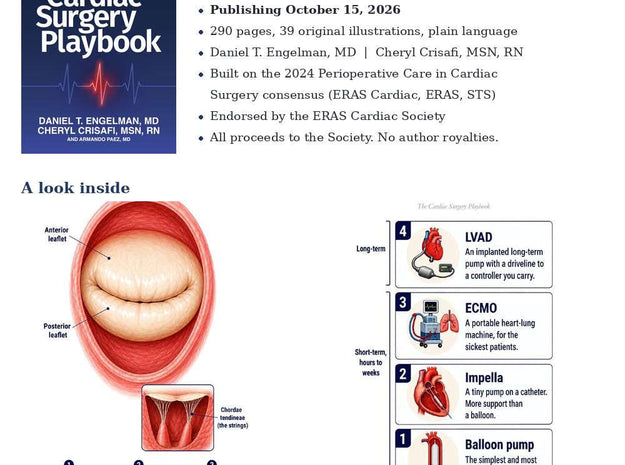The Cardiac Surgery Playbook: A New Guide to Understanding, Preparing for, and Recovering from Heart Surgery