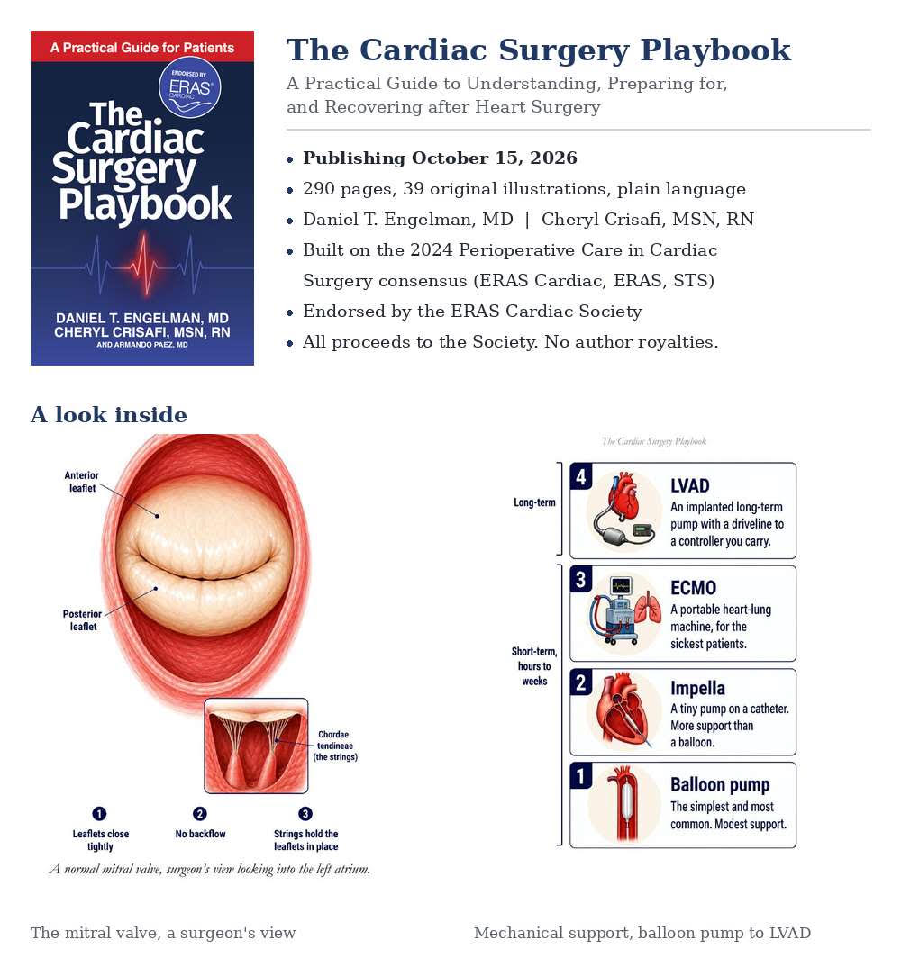 The Cardiac Surgery Playbook: A New Guide to Understanding, Preparing for, and Recovering from Heart Surgery